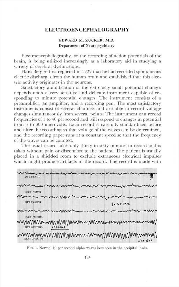 PDF extract preview