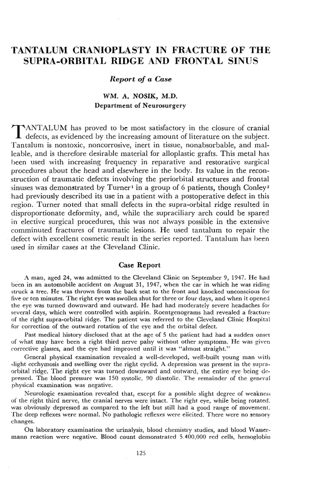 PDF extract preview