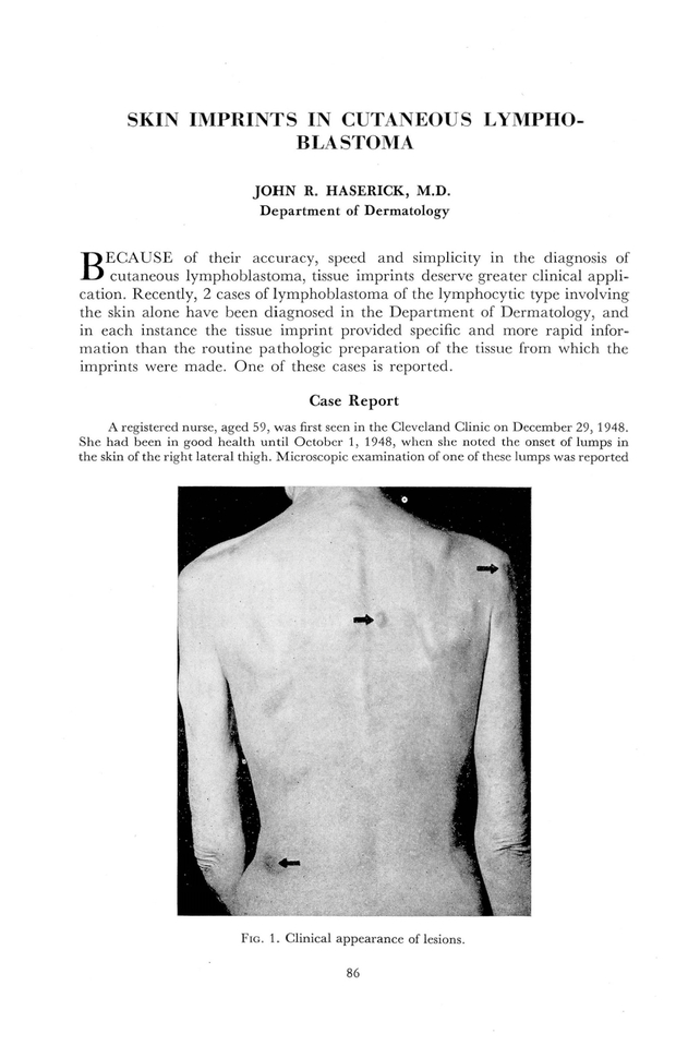PDF extract preview