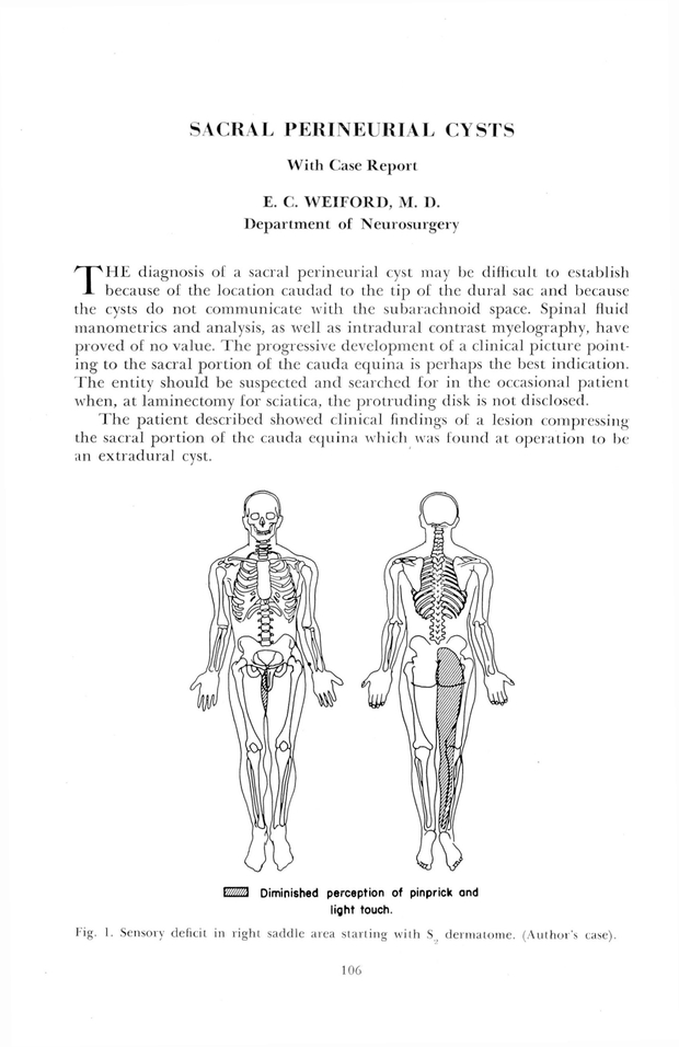 PDF extract preview