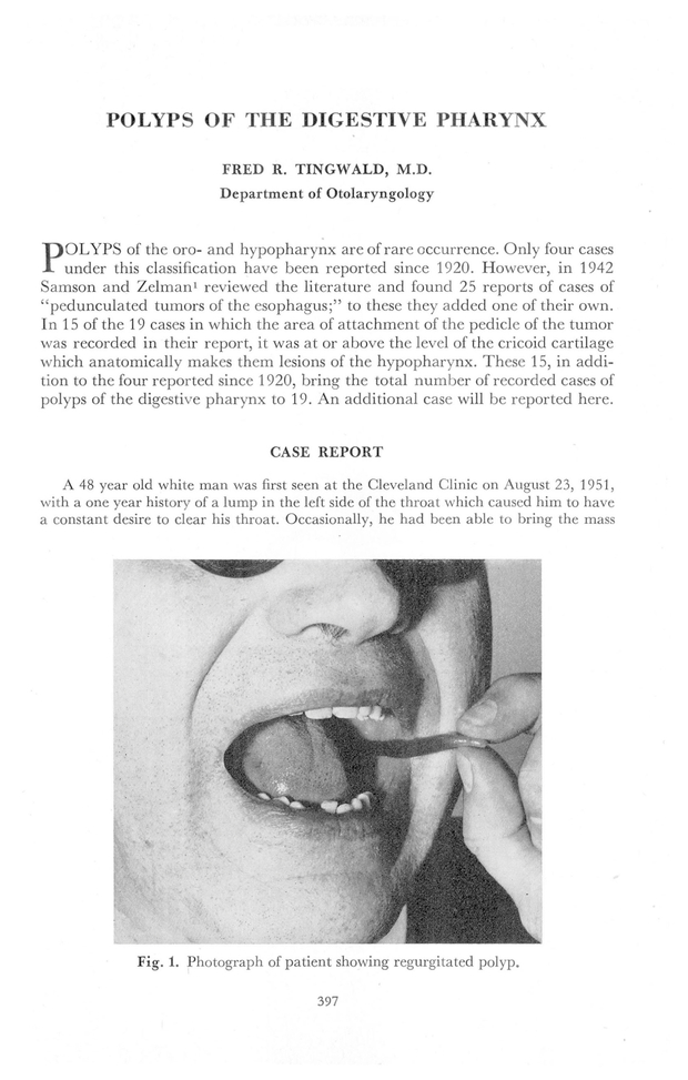 PDF extract preview