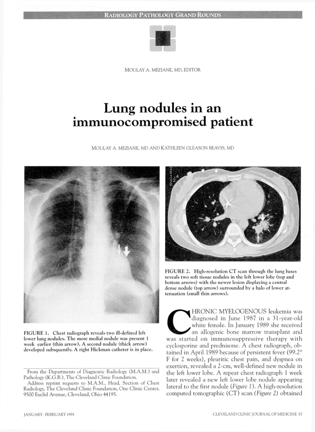 PDF extract preview