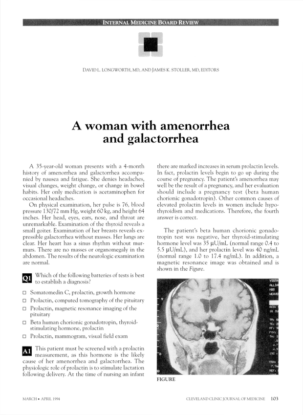 PDF extract preview
