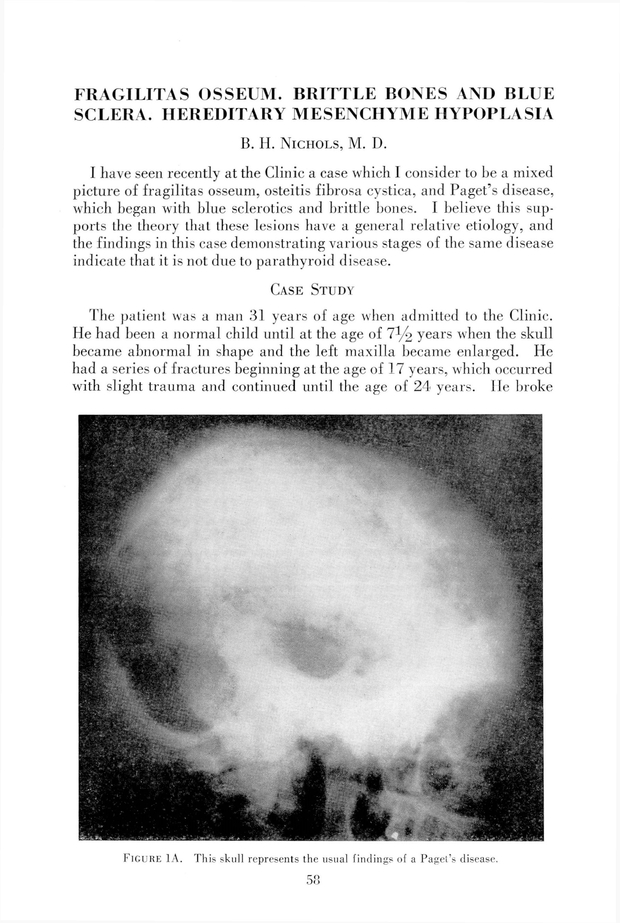 PDF extract preview
