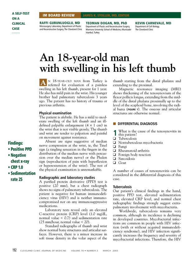 PDF extract preview