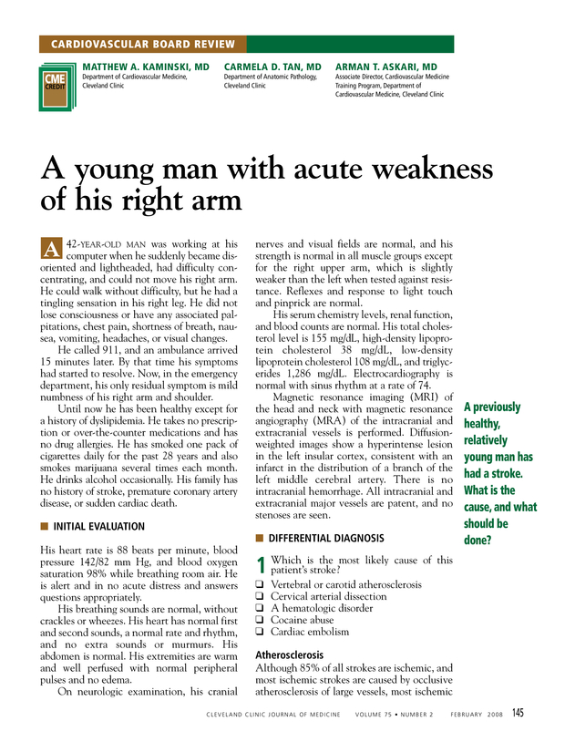 PDF extract preview