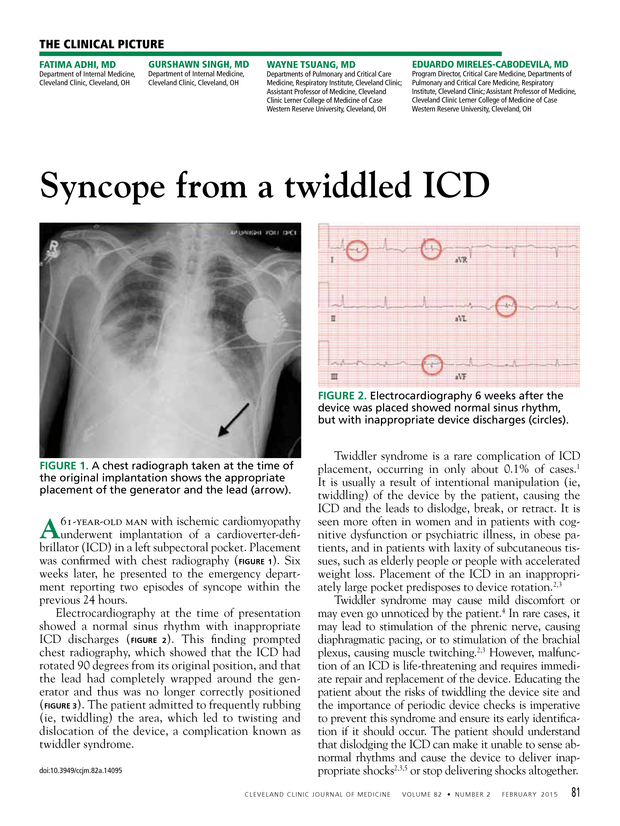 PDF extract preview