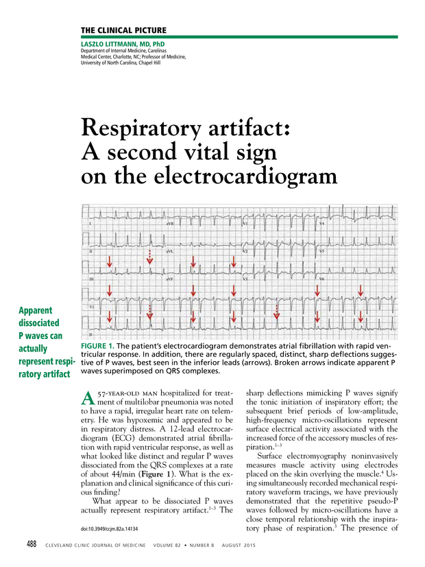 PDF extract preview