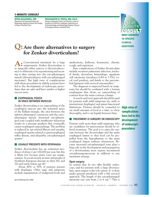 Are there alternatives to surgery for Zenker diverticulum? | Cleveland