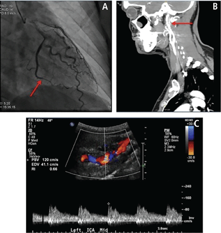 FIGURE 3