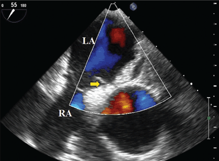 FIGURE 3