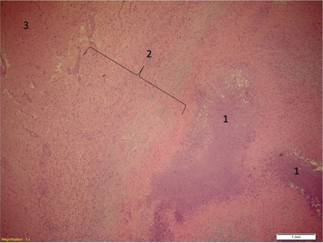 Diagnostics | Free Full-Text | The Diagnostic Deceiver: Radiological  Pictorial Review of Tuberculosis