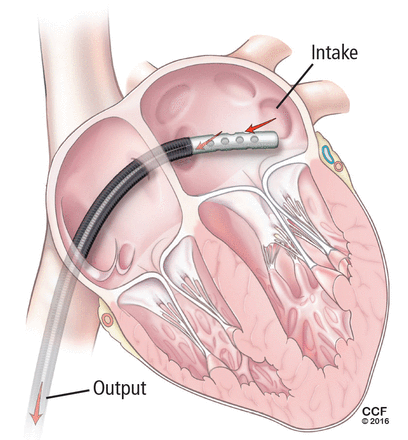 FIGURE 4