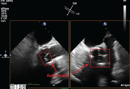 Figure 1A