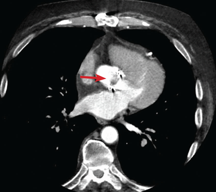 Figure 1B