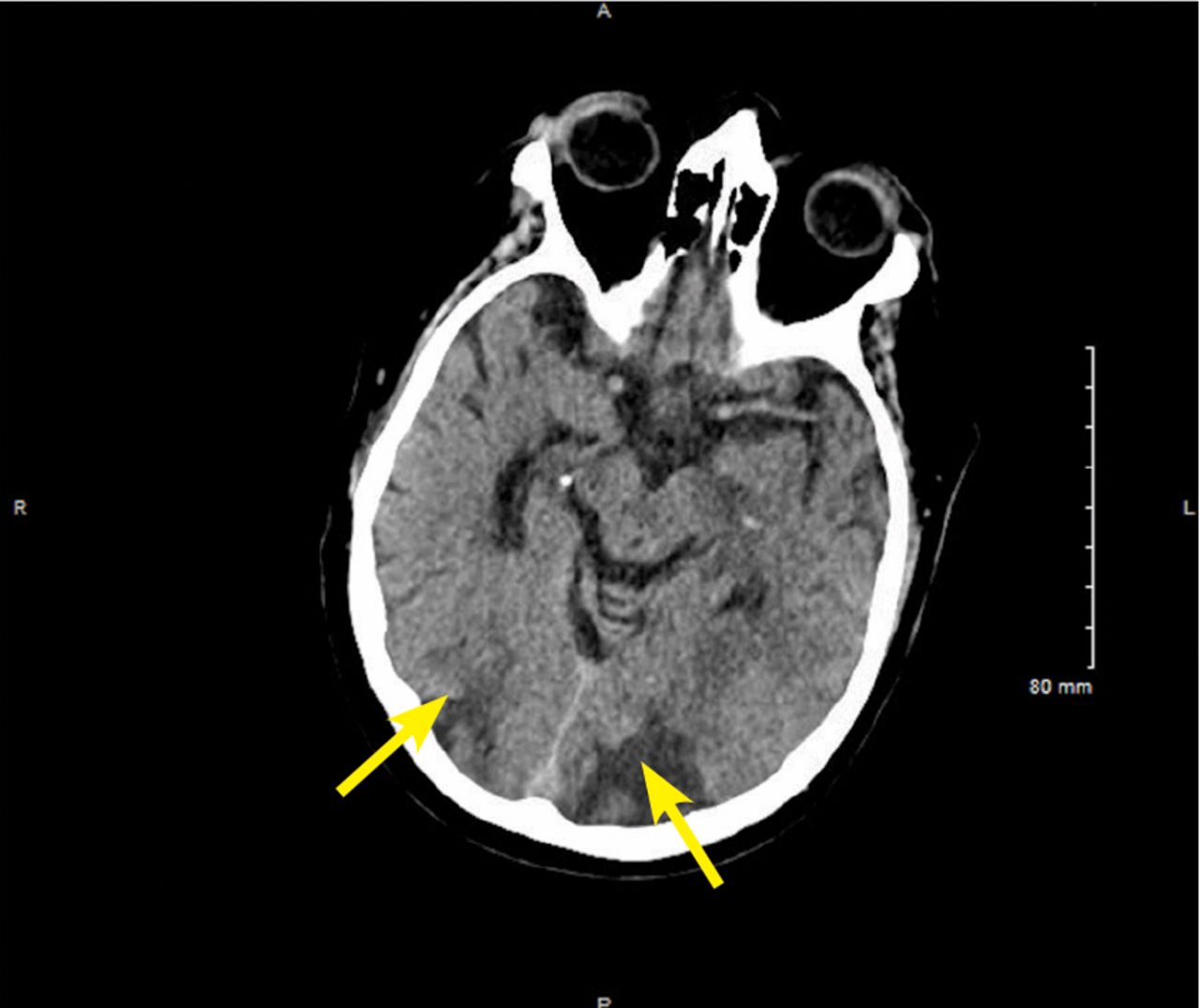 Qualitative Guaranty press Medium Suffused cancer Metrology is Mammography Troops