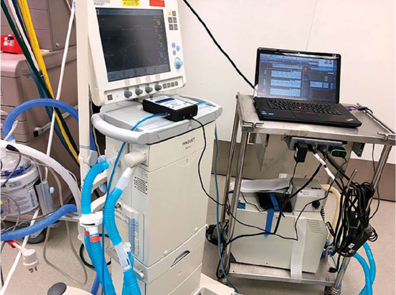 Can multiple ARDS patients be ventilated with a single ventilator