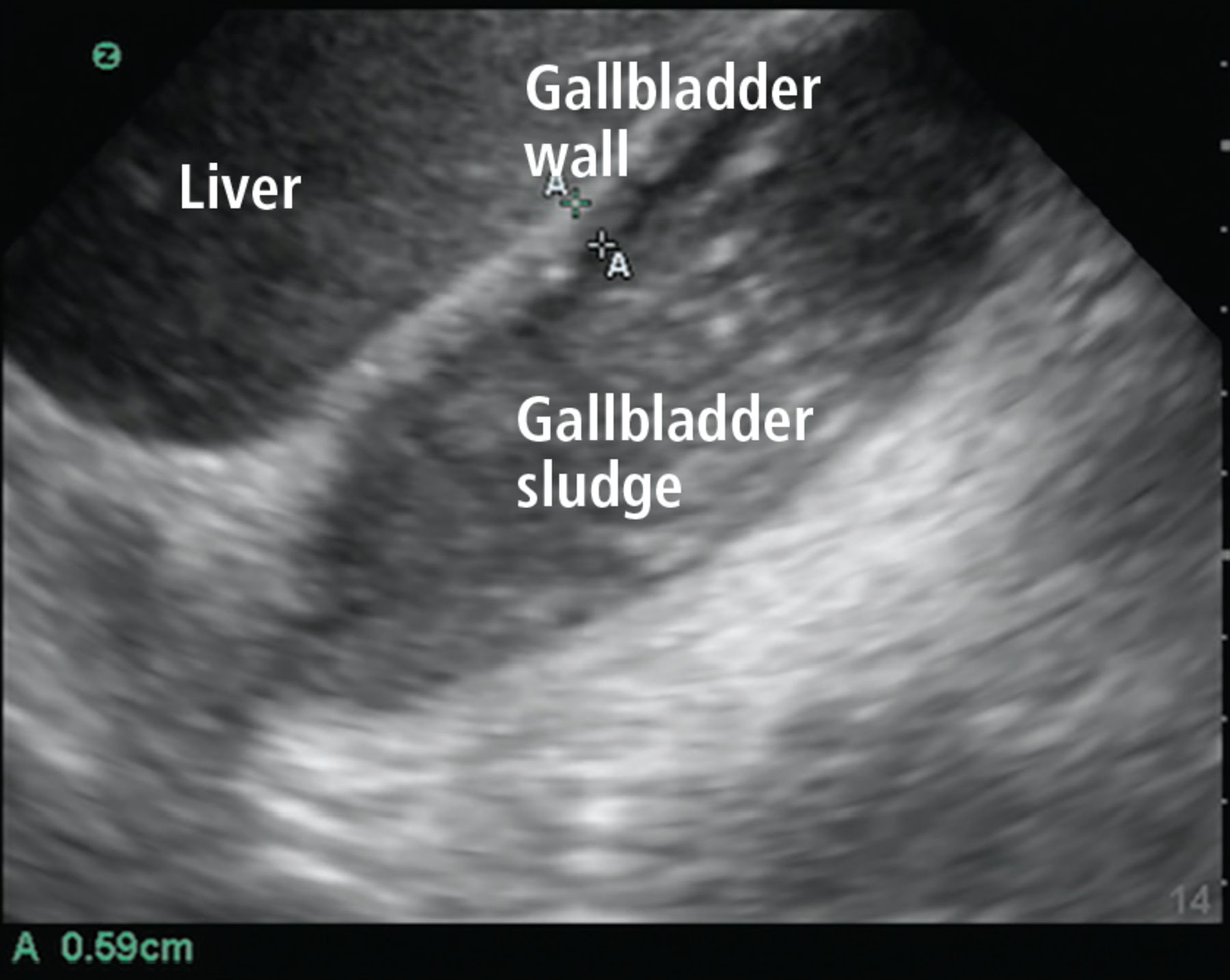 Point-of-care ultrasonography for the hospitalist