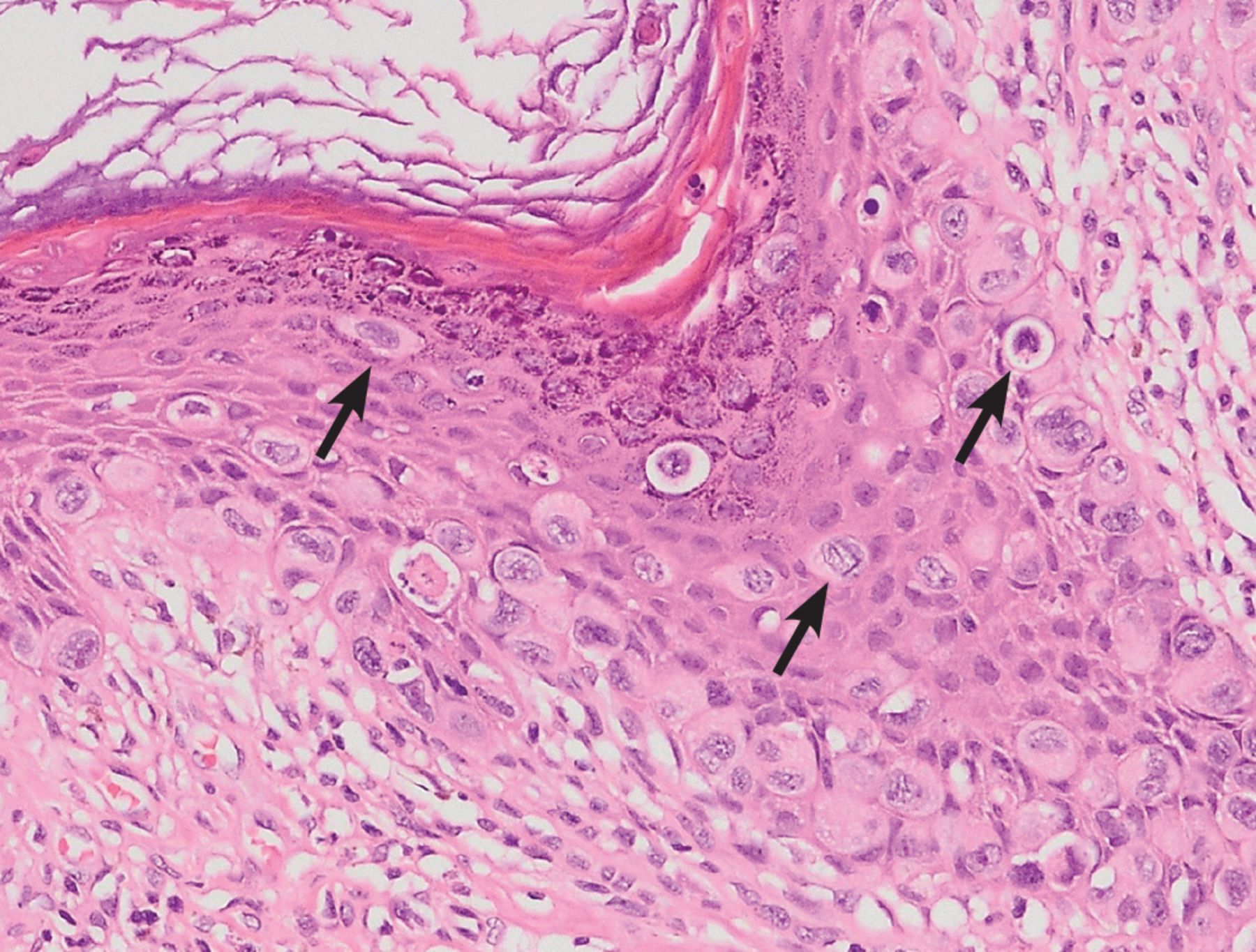 Pale Areolas