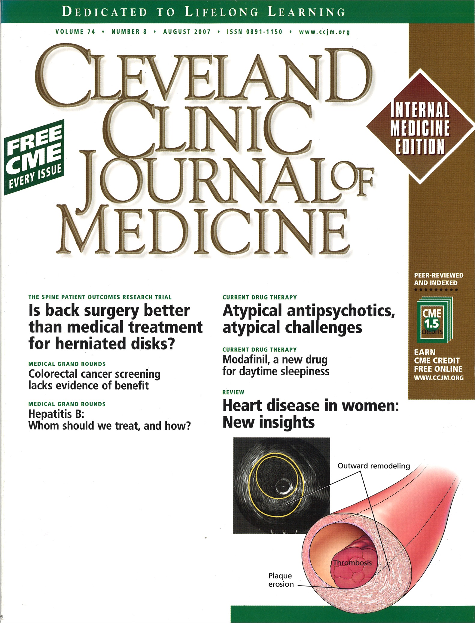 Atypical antipsychotics New drugs, new challenges Cleveland Clinic