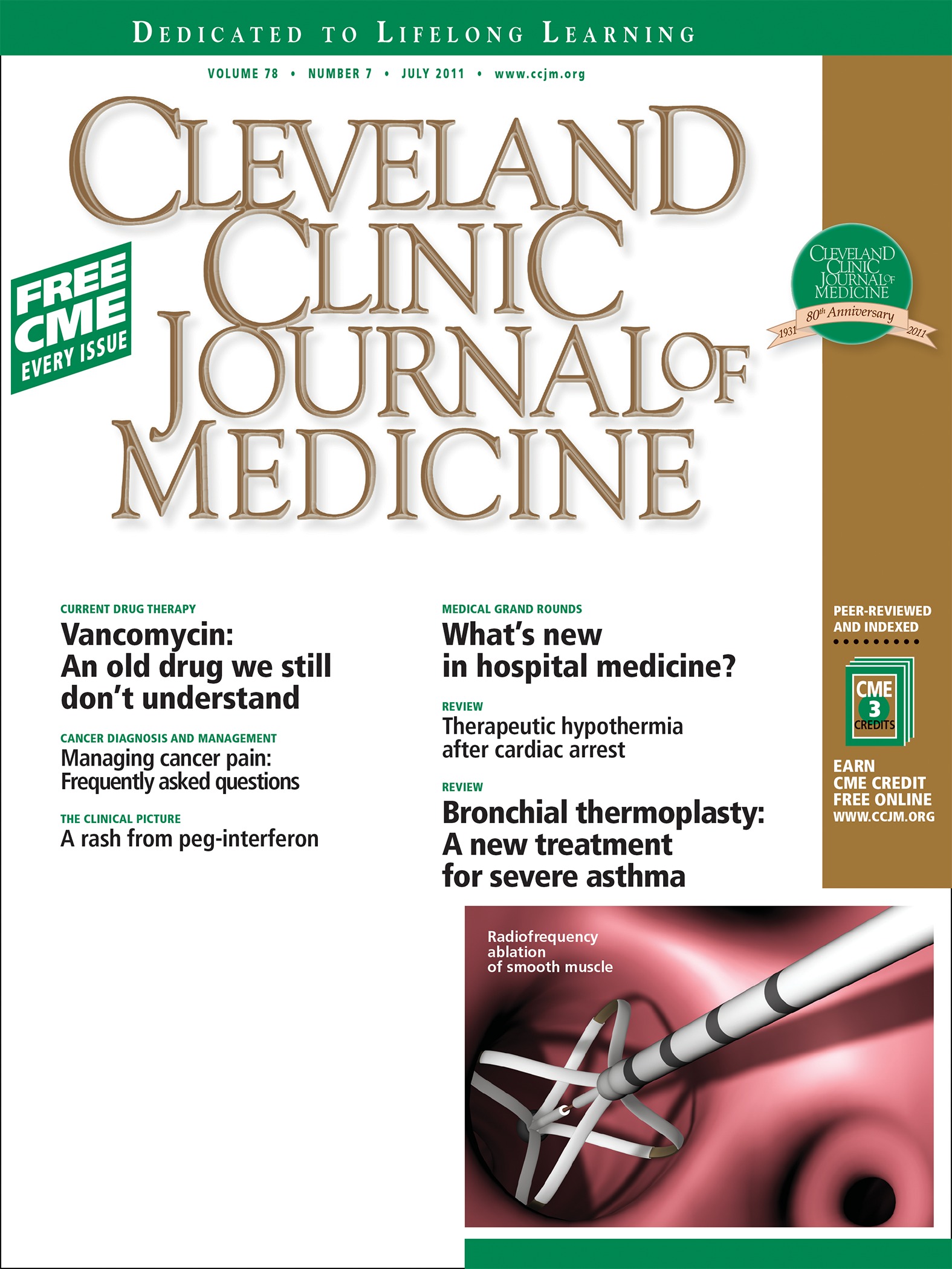 Rash from hepatitis C treatment | Cleveland Clinic Journal