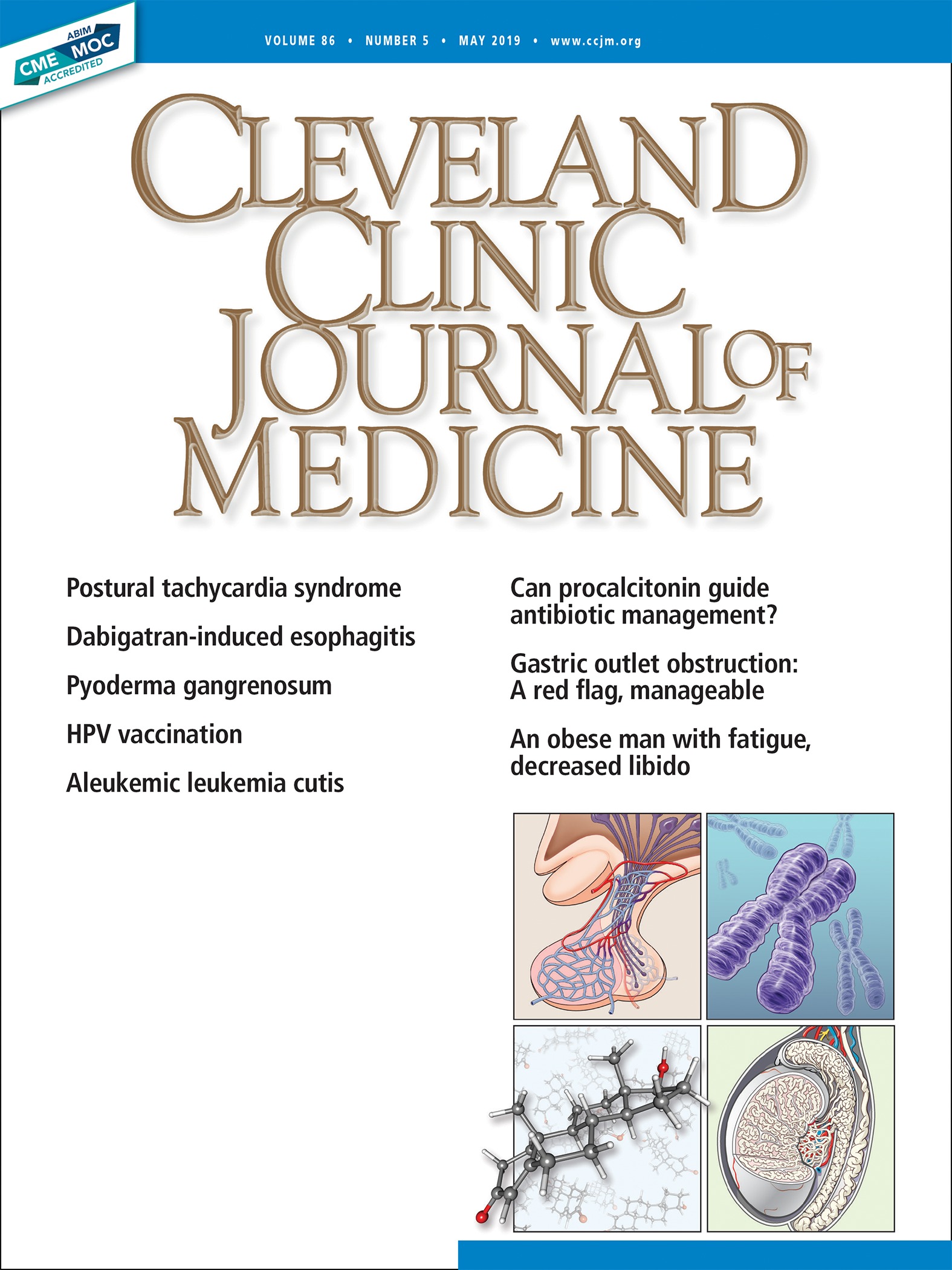 Evaluating and managing postural tachycardia syndrome