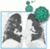 Thoracic imaging in COVID-19