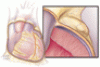 Don’t judge a book by its cover: Unusual presentations of pericardial disease
