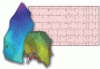 Evaluation and management of premature ventricular complexes