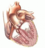 A 23-year-old man with a continuous heart murmur