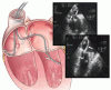 Detecting and managing device leads inadvertently placed in the left ventricle