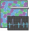 Using and interpreting electrodiagnostic tests