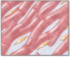Cardiovascular complications of systemic sclerosis: What to look for