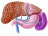 Preventing a first episode of esophageal variceal hemorrhage