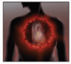 SARS-CoV-2 and myocardial injury: Few answers, many questions
