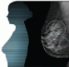 Breast cancer screening: Does tomosynthesis augment mammography?