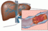 Beta-cell therapies for type 1 diabetes: Transplants and bionics