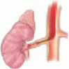 Renovascular hypertension: Balancing the controversies in diagnosis and treatment