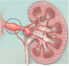 Optimal surveillance and treatment of renal and splenic artery aneurysms