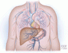 Portopulmonary hypertension: A focused review for the internist