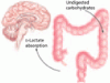 A 58-year-old woman with mental status changes