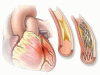 PCI for stable angina: A missed opportunity for shared decision-making