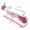 Sepsis: Menu of new approaches replaces one therapy for all