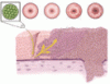 Cervical cancer screening: Less testing, smarter testing