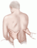 Diagnostic value of the physical examination in patients with dyspnea