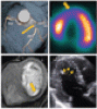 Stress testing and noninvasive coronary imaging: What’s the best test for my patient?