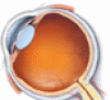 Acute monocular vision loss: Don’t lose sight of the differential