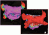 Ablation of atrial fibrillation: Facts for the referring physician