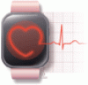 Consumer-grade wearable cardiac monitors: What they do well, and what needs work