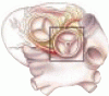 Calcific aortic stenosis: Another face of atherosclerosis?